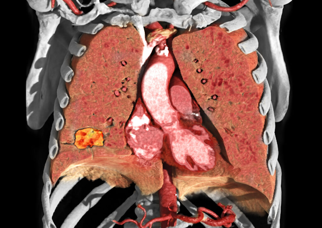 Introduction to Vitrea Advanced Visualization Version 7